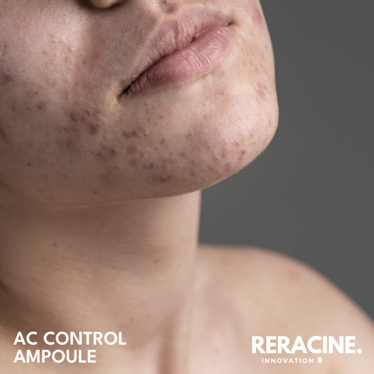 [RERACINE] AC Control Ampoule 30ml