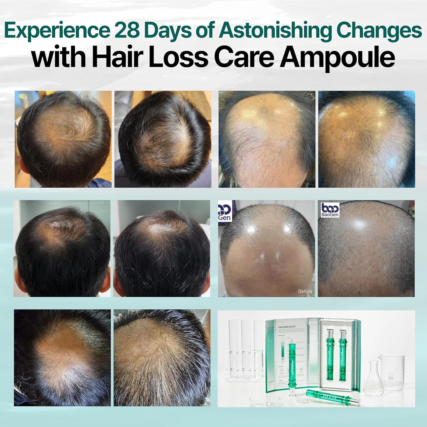 [BAO H. LAB] Hair Loss Care Ampoule